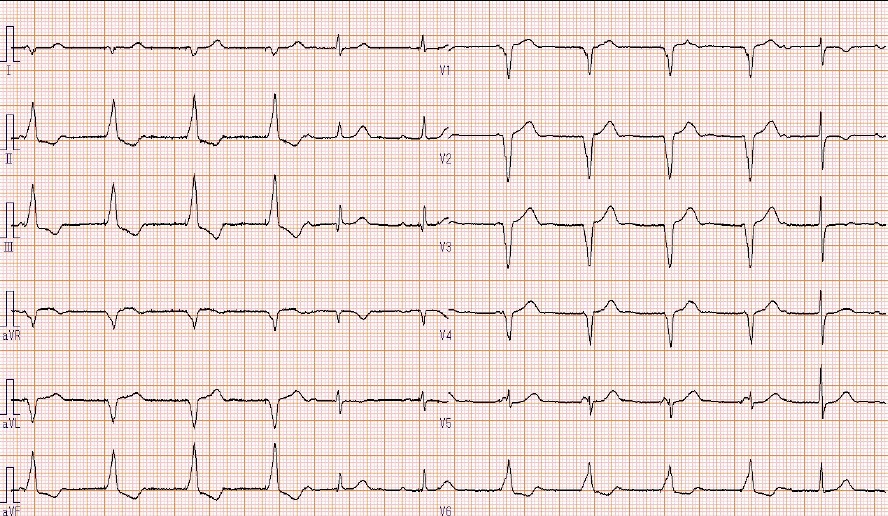 外来受診時の心電図